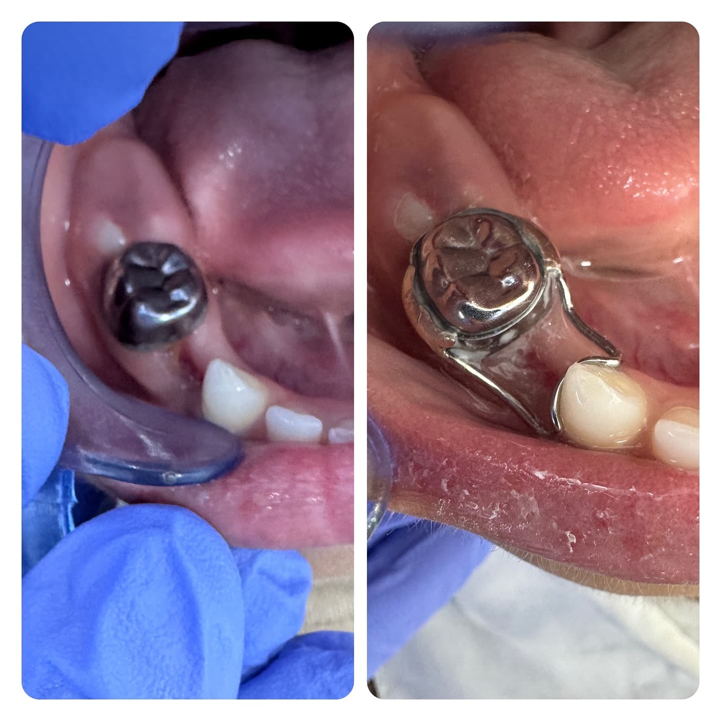 Before & After Case 2