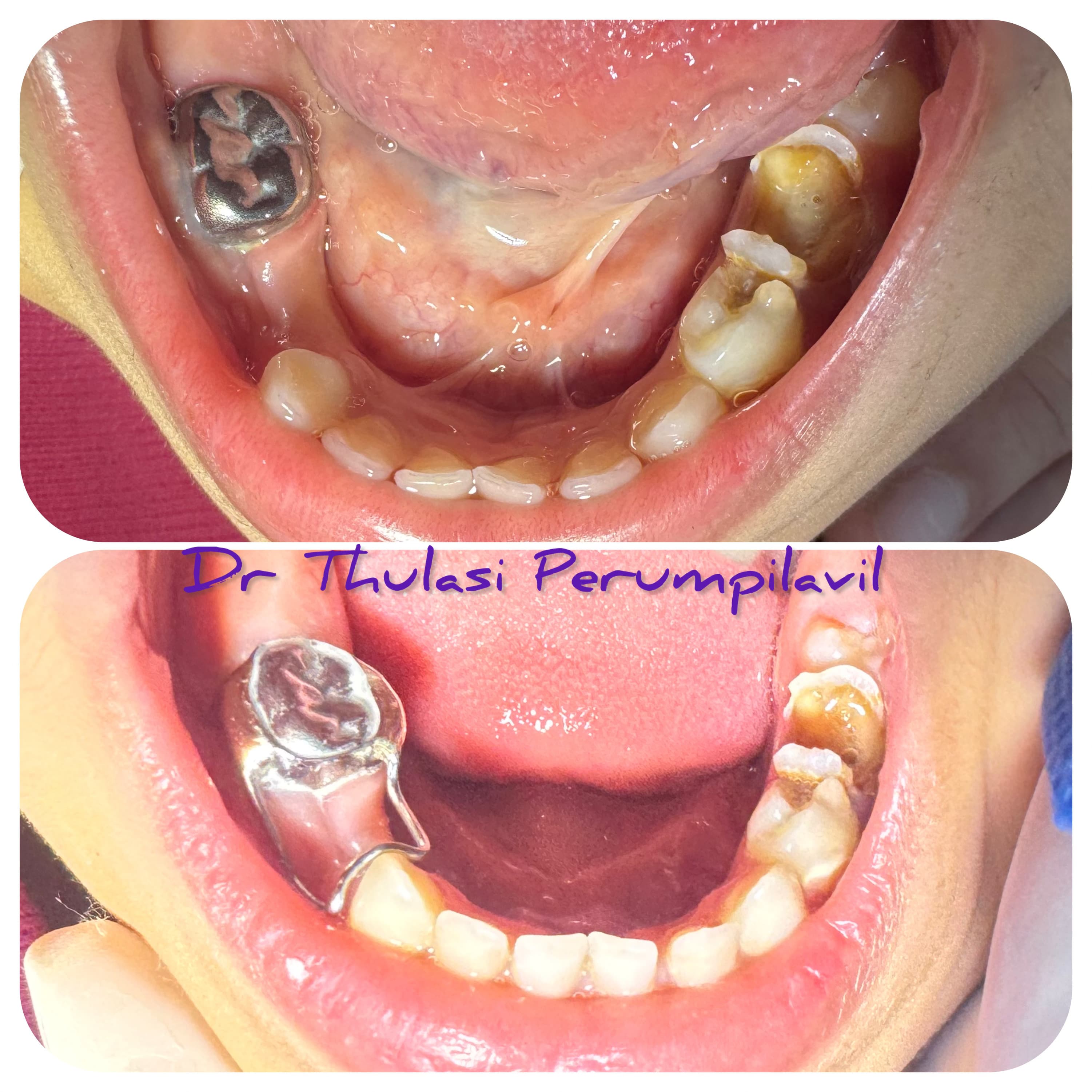 Before & After Case 3